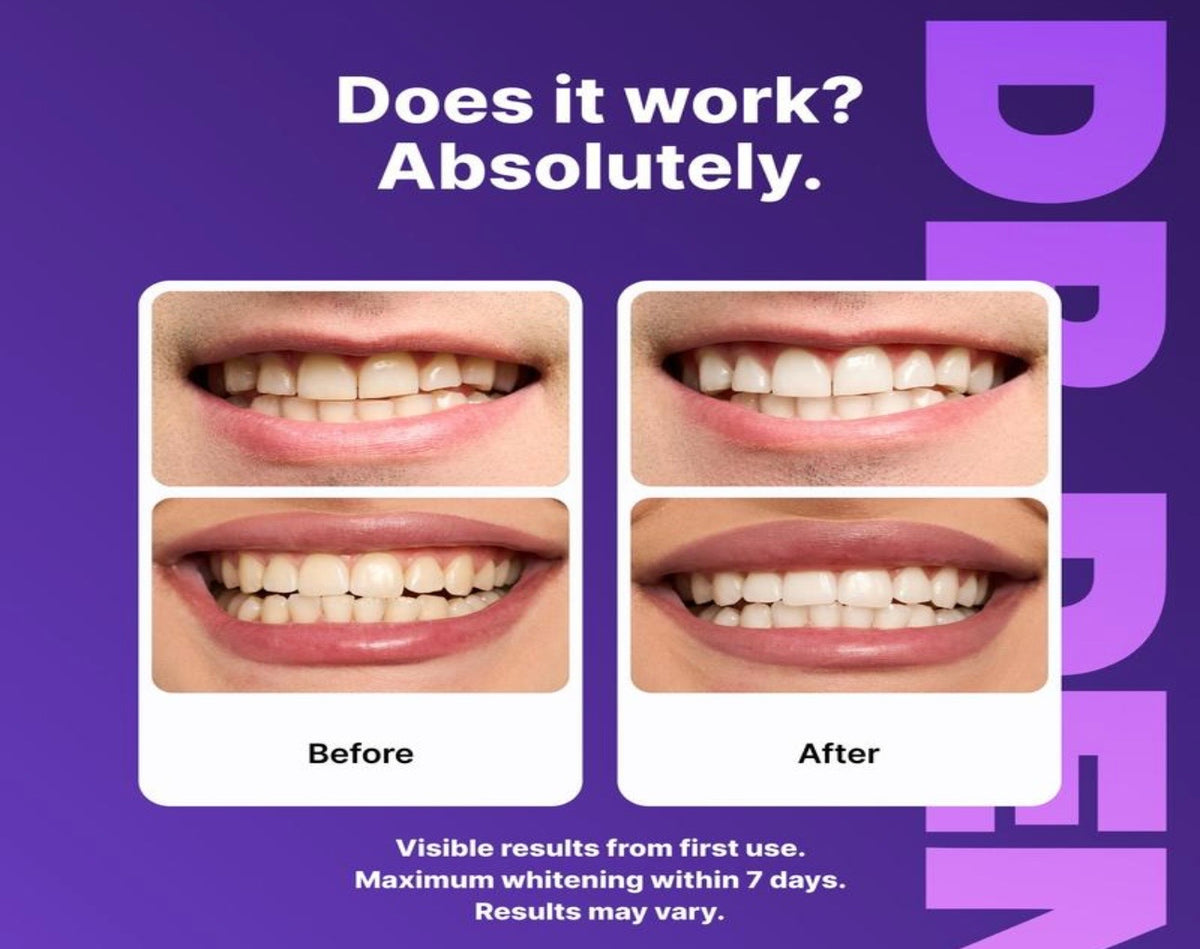 DR dent Purple Teeth Strips | Care for the Enamel Layer, Non-Toxic, Enamel Safe