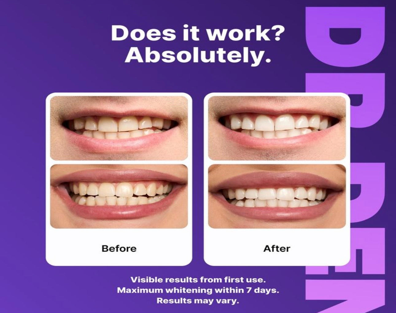 DR dent Purple Teeth Strips | Care for the Enamel Layer, Non-Toxic, Enamel Safe